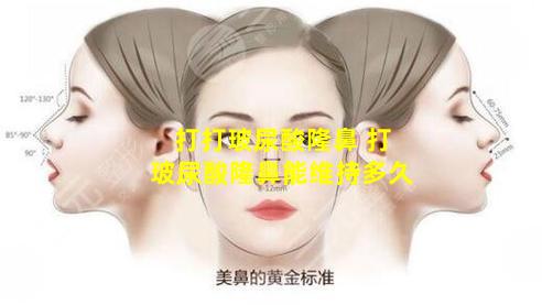 打打玻尿酸隆鼻 打玻尿酸隆鼻能维持多久